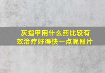 灰指甲用什么药比较有效治疗好得快一点呢图片