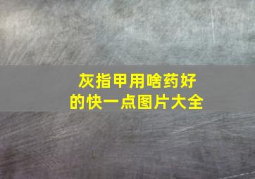 灰指甲用啥药好的快一点图片大全