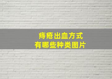 痔疮出血方式有哪些种类图片