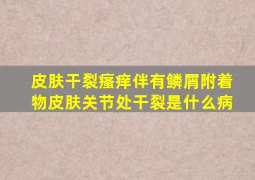 皮肤干裂瘙痒伴有鳞屑附着物皮肤关节处干裂是什么病