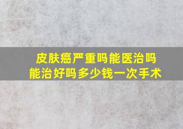 皮肤癌严重吗能医治吗能治好吗多少钱一次手术