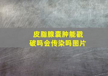 皮脂腺囊肿能戳破吗会传染吗图片