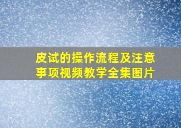 皮试的操作流程及注意事项视频教学全集图片