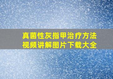 真菌性灰指甲治疗方法视频讲解图片下载大全