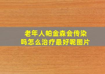 老年人帕金森会传染吗怎么治疗最好呢图片