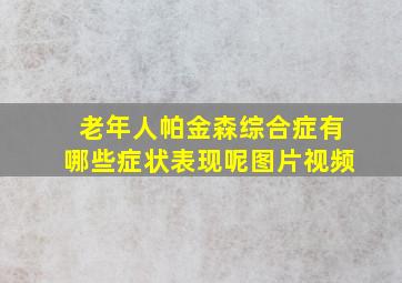 老年人帕金森综合症有哪些症状表现呢图片视频