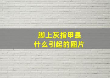 脚上灰指甲是什么引起的图片