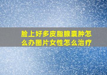 脸上好多皮脂腺囊肿怎么办图片女性怎么治疗