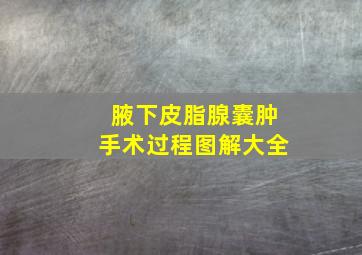 腋下皮脂腺囊肿手术过程图解大全