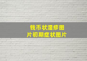 钱币状湿疹图片初期症状图片