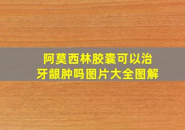 阿莫西林胶囊可以治牙龈肿吗图片大全图解