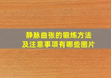 静脉曲张的锻炼方法及注意事项有哪些图片